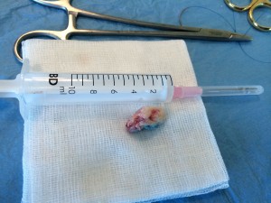 endo velika 5